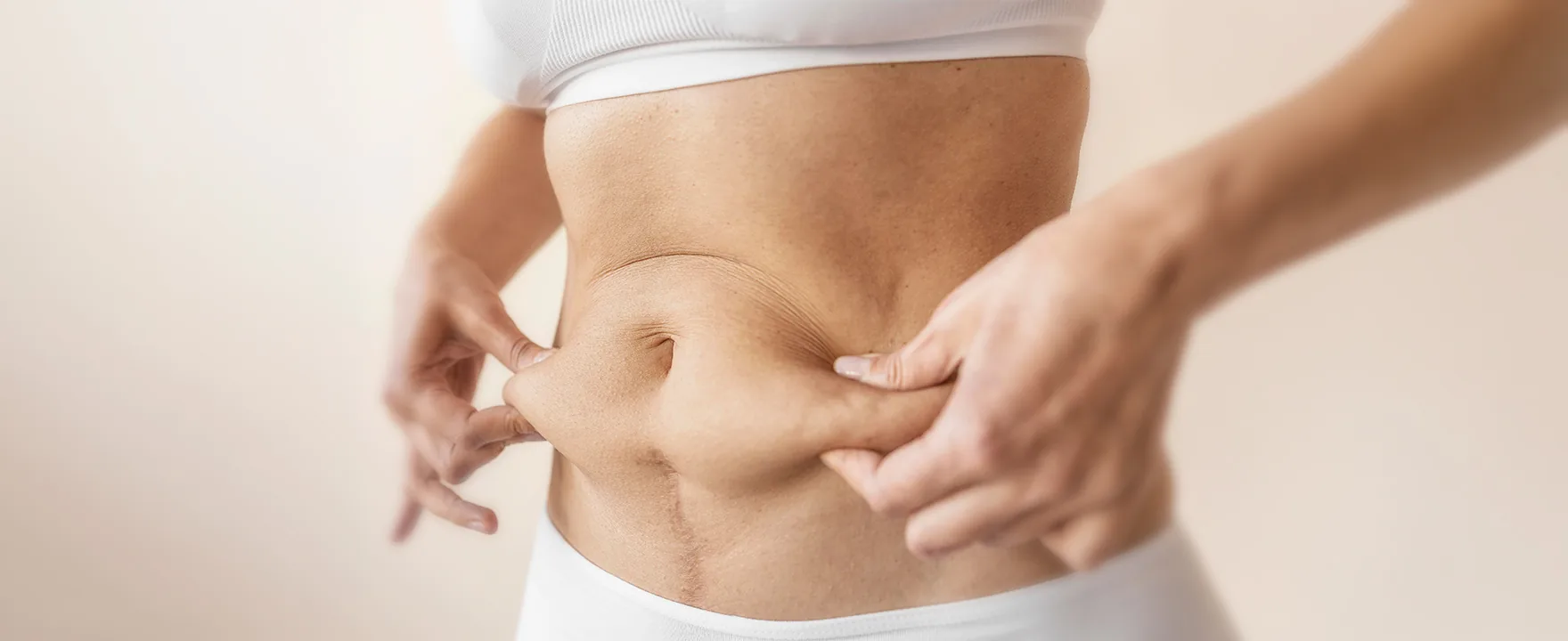 Liposuction