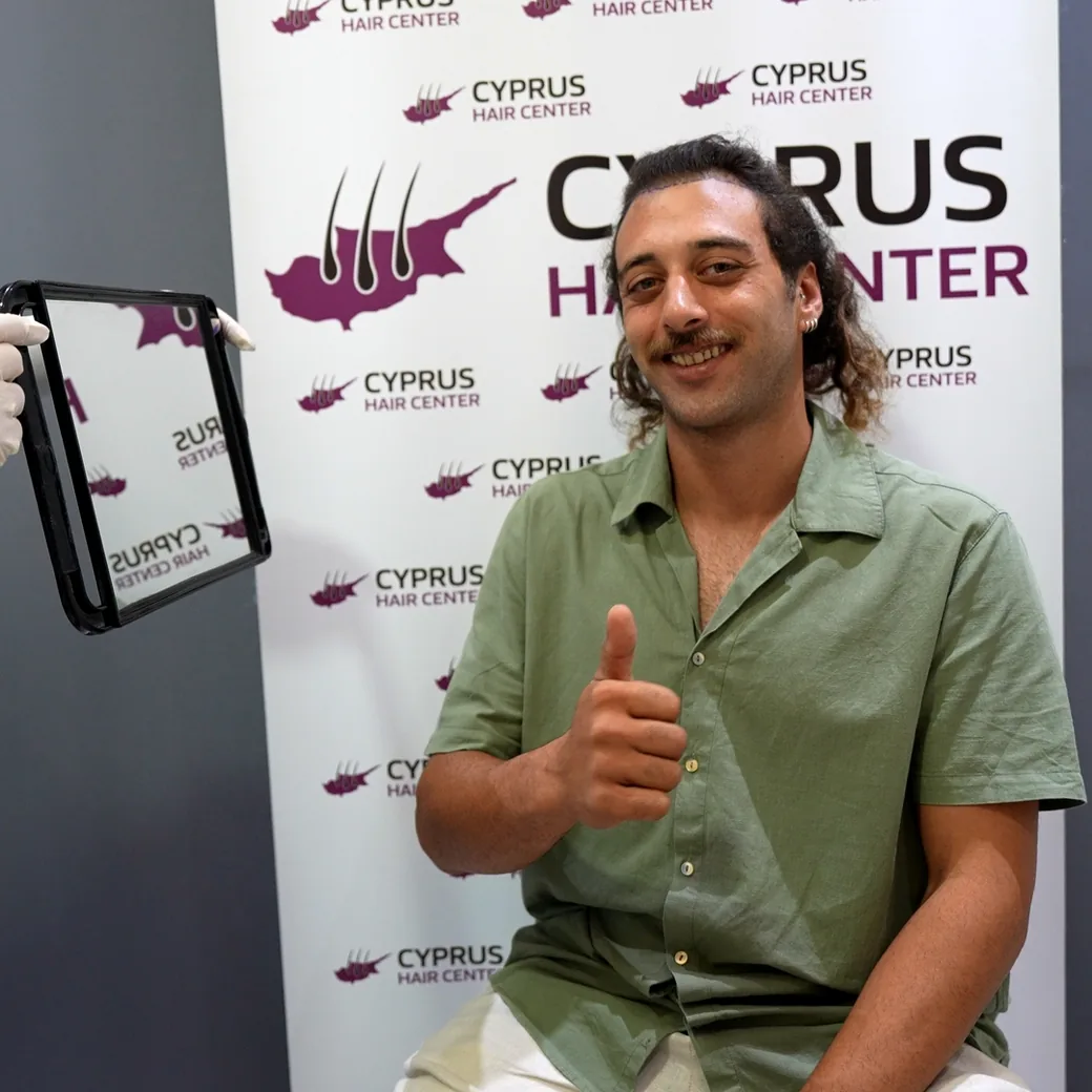 Smiling patient giving a thumbs up after the operation at Cyprus Hair Center