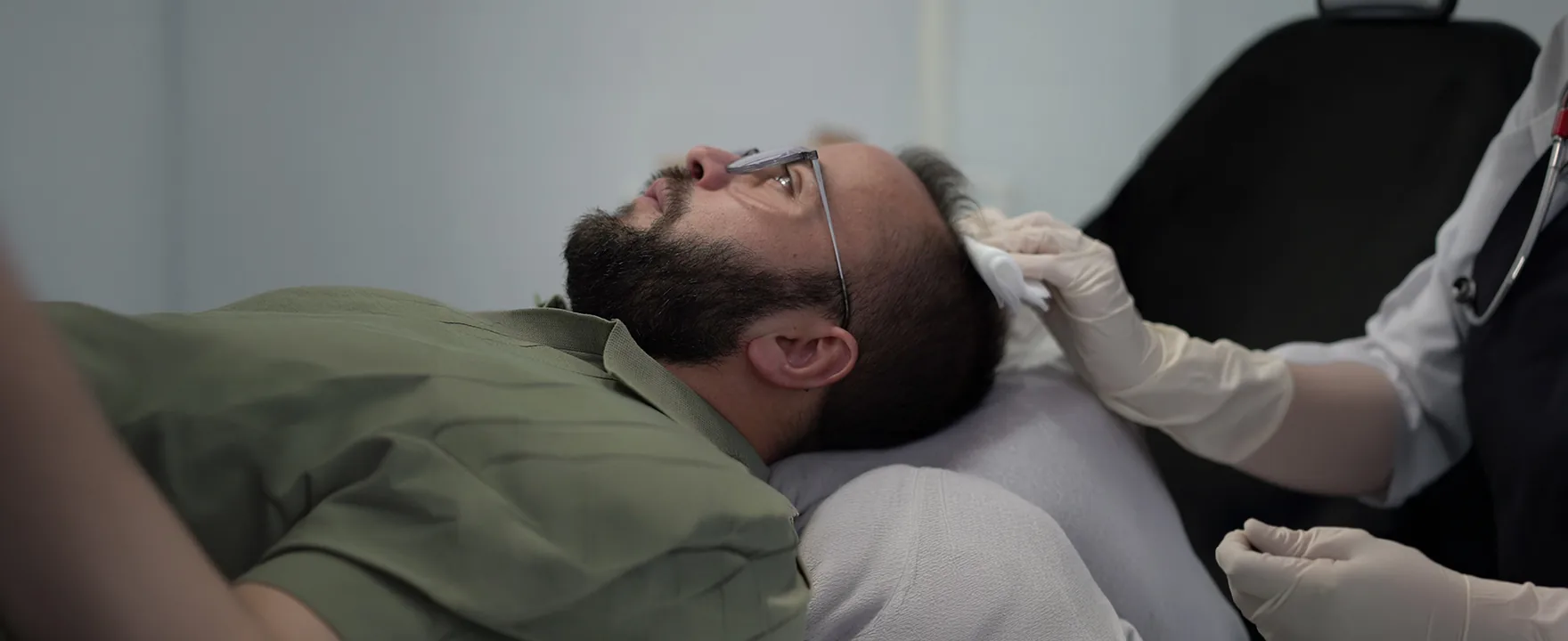 Exosome solution being prepared for a scalp treatment at Cyprus Hair Center, Nicosia