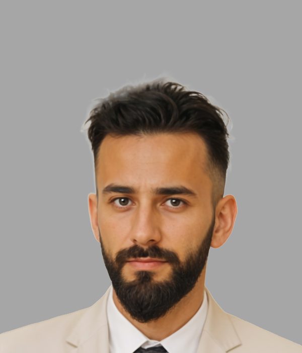 Hair transplant result, after