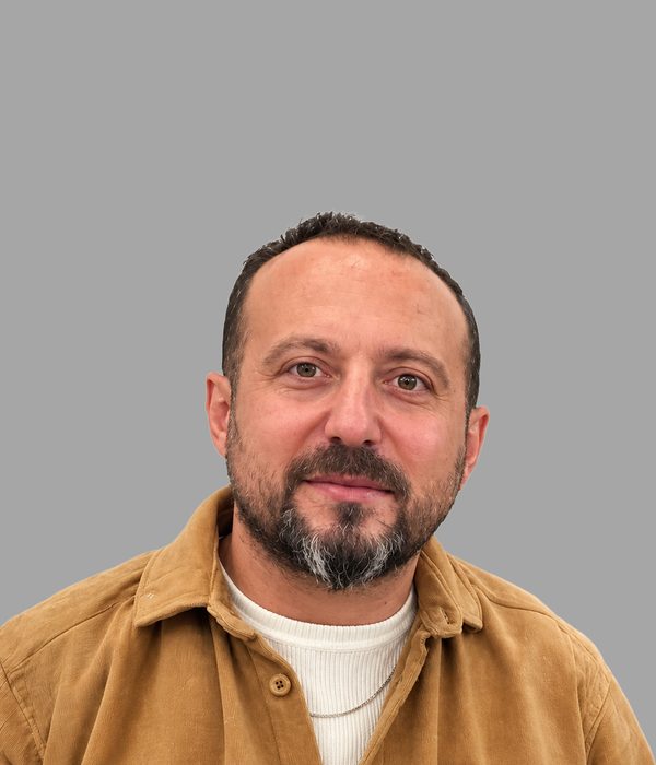 Hair transplant result, before