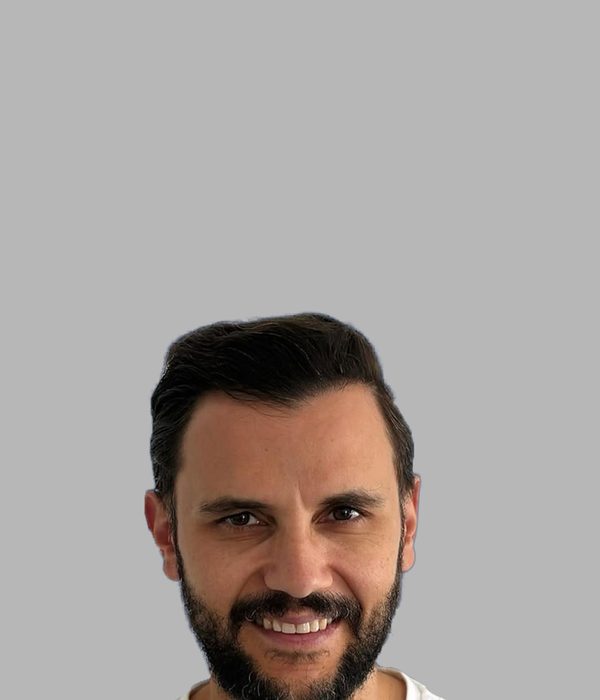 Hair transplant result, after